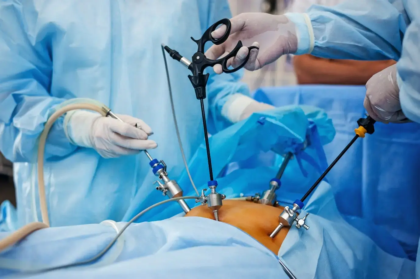 Gynecological Surgeons in action