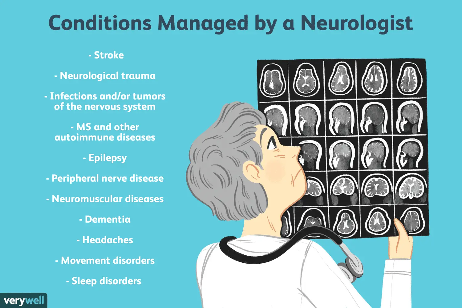 Conditions managed by a neurologist