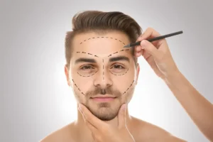 preparing for cosmetic surgery