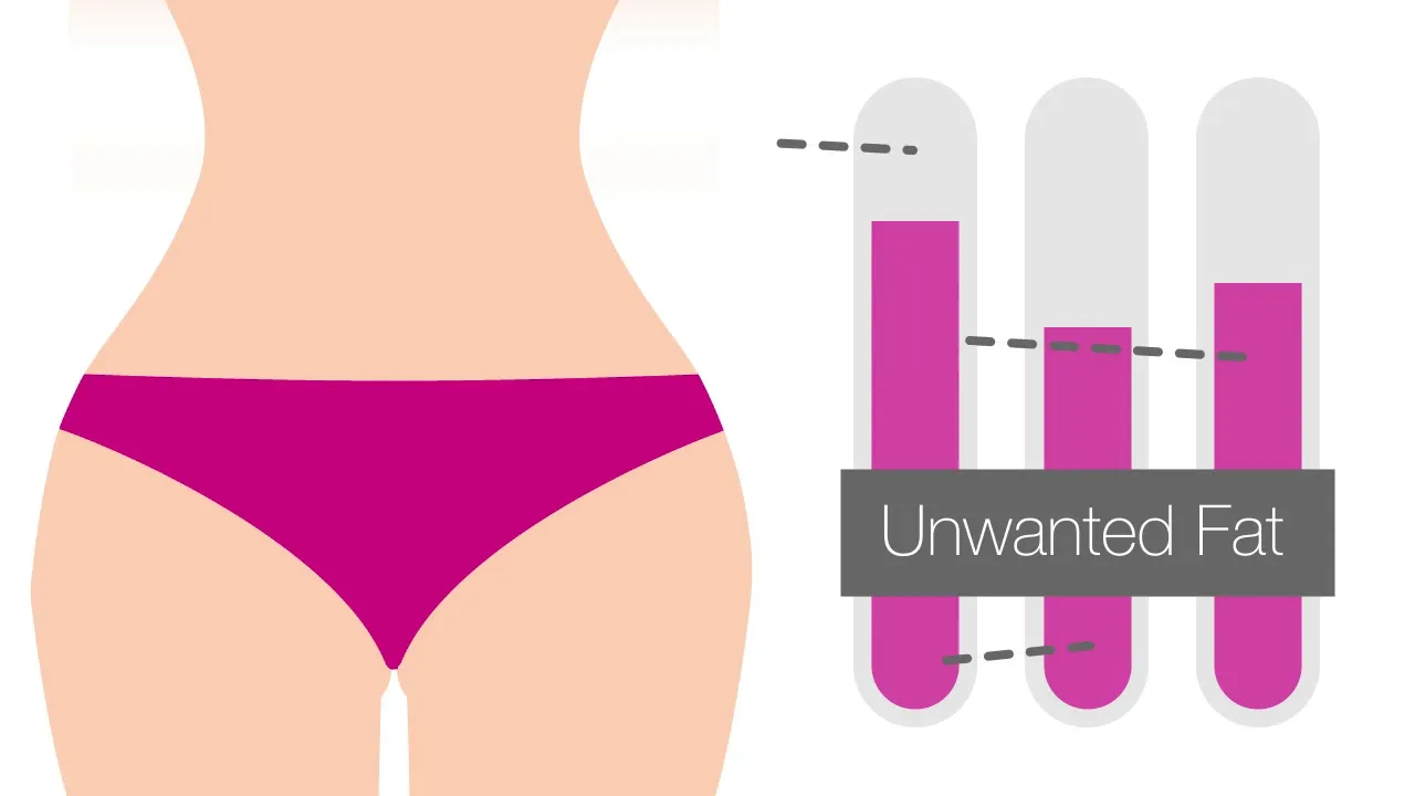 Plastic surgery - Brazilian Butt Lift